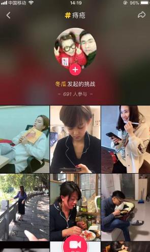 抖音周云鹏痔疮段子怎么拍？抖音周云鹏配音怎么弄？[多图]图片2