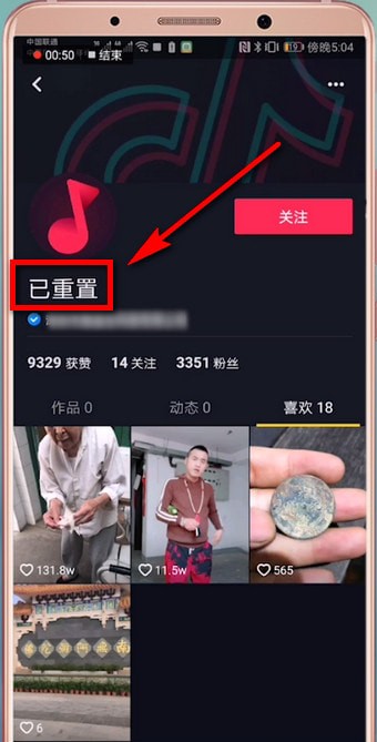 抖音短视频将重置恢复的具体操作流程